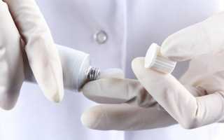 Лечение молочницы мазью и кремами