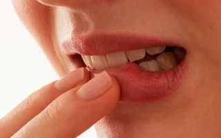 Кандидозный стоматит — симптоматика, причины и лечение