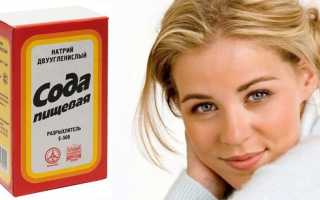 Как помогает спринцевание содой при молочнице