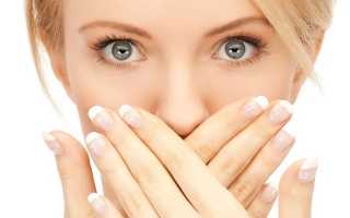 Орофарингеальный кандидоз