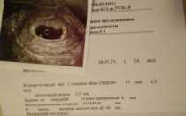 Через сколько дней после зачатия плодное яйцо опускается в матку