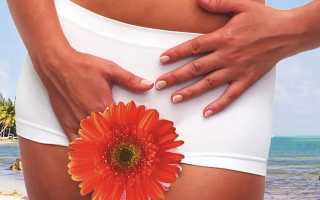 Почему появляется запах при молочнице