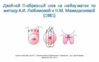 Какой образ жизни после наложения швов на шейку матки при беременности