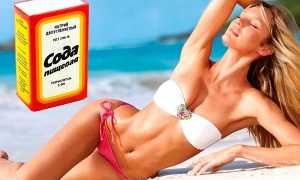 Как проводить лечение молочницы содой