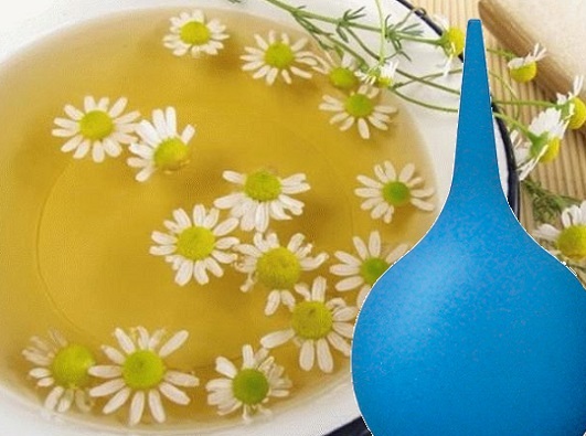 Спринцевание ромашкой