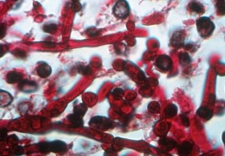 Грибок Кандида