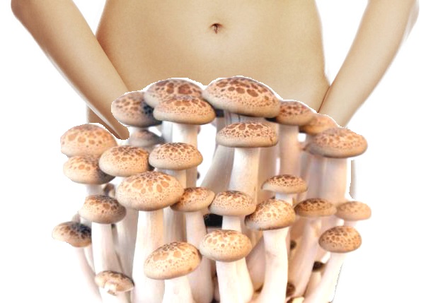 Вагинальный кандидоз