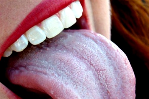 Налет на языке