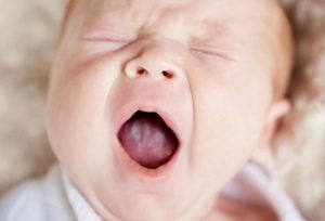 Молочница у ребенка