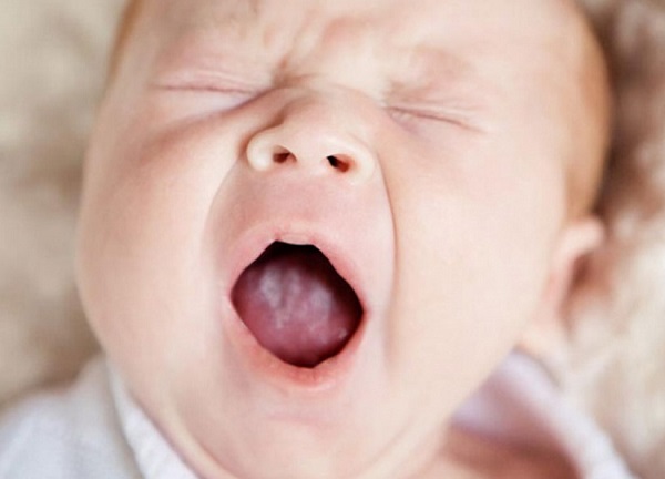 Признаки молочницы у ребенка