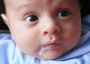 Срыгивание у ребенка