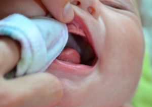 Обработка рта малыша