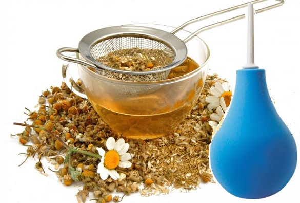 Спринцевание ромашкой