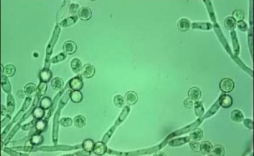 Грибок Кандида