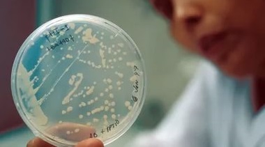 Бактериальный посев