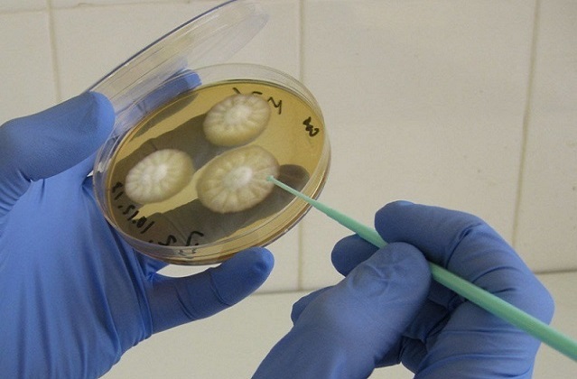 Посев на грибок