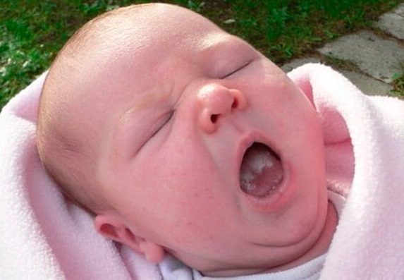 Молочница у грудничка