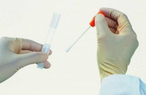 Мазок из уретры