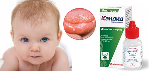 Кандид для детей