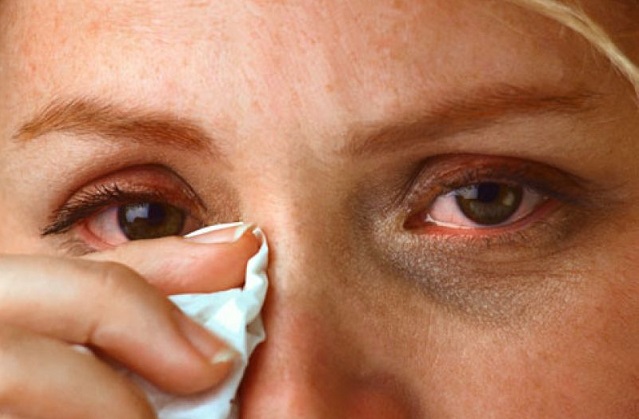 Кандидоз глаз