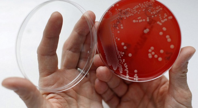 Бактериальный посев