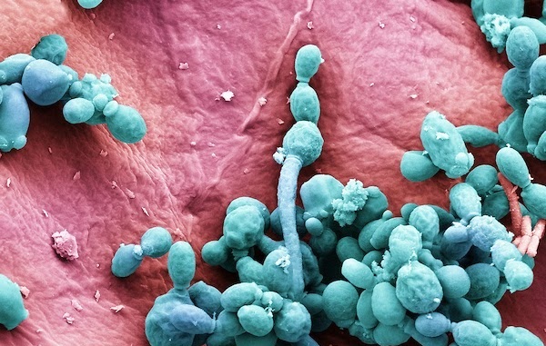 Рост грибковой инфекции