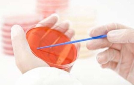 Анализ на грибковую микрофлору