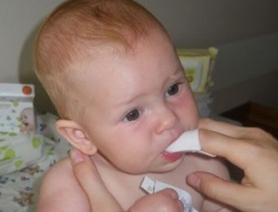 Обработка рта у ребенка